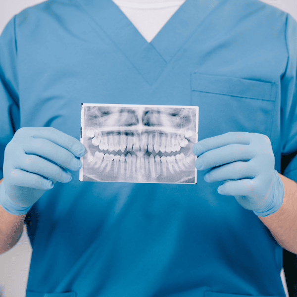 Teeth Replacement Image